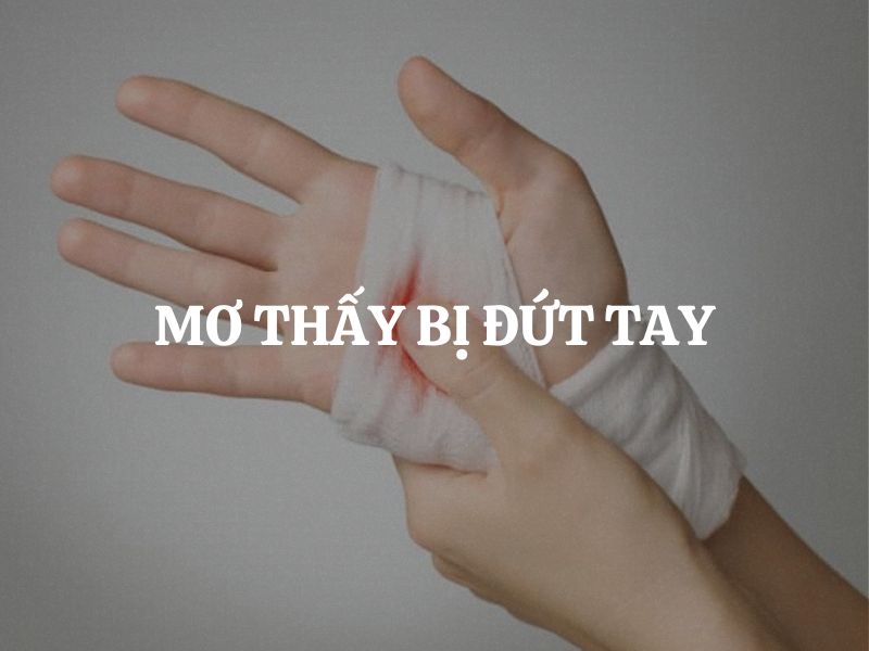 Mơ thấy bị đứt tay là điềm lành hay dữ? Giải mã chi tiết từng trường hợp